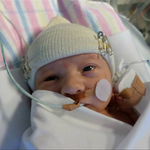 baby Carnley at bith