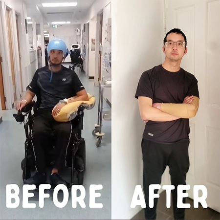 Nathan before and after photo