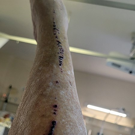 Denise and her scraped leg